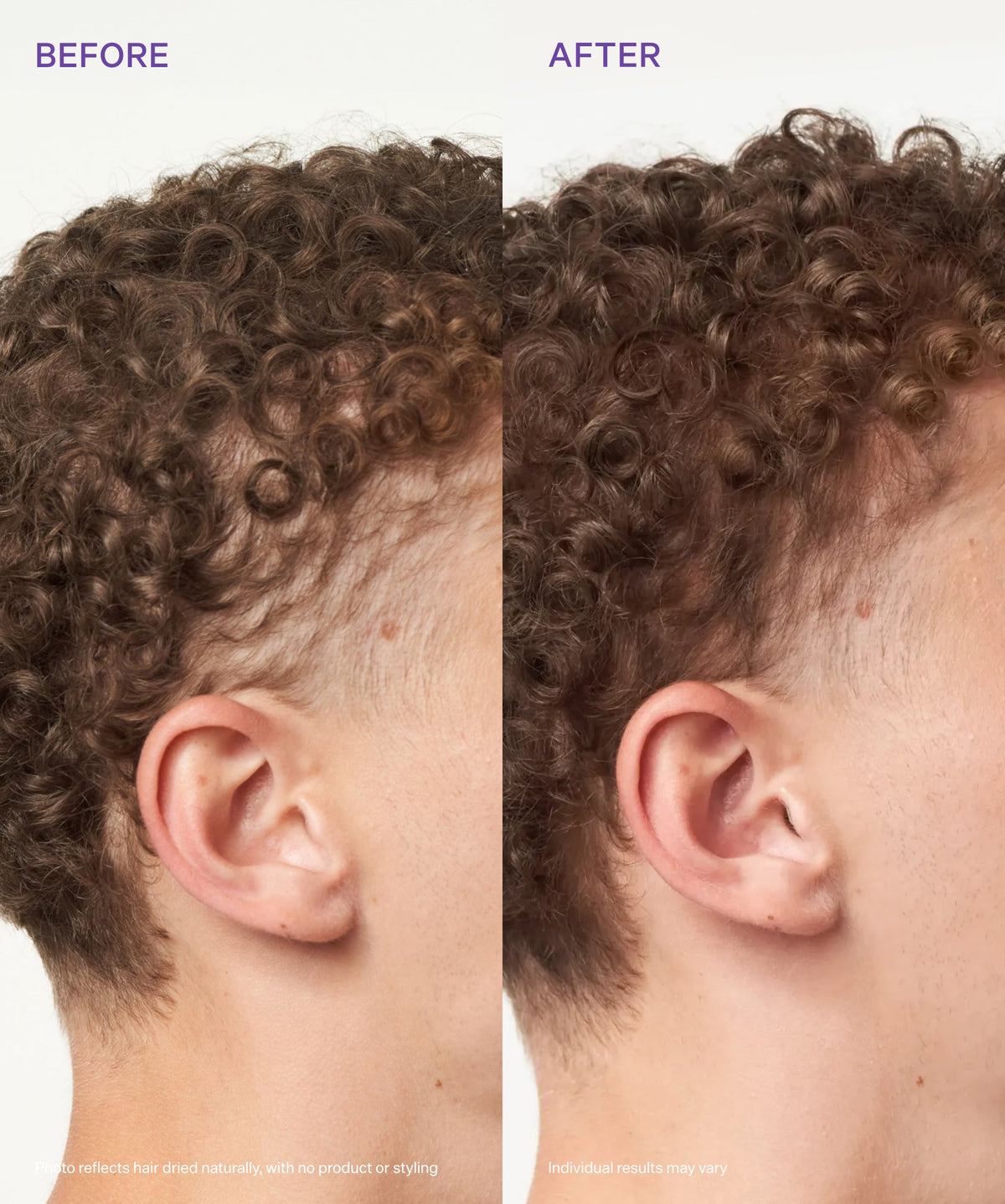 Scalp Revitalizing Solution Miracle in Shower Treatment