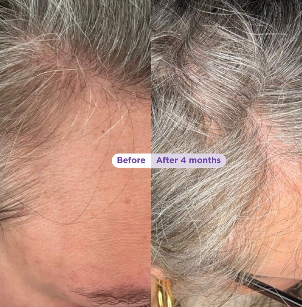 Visible Results