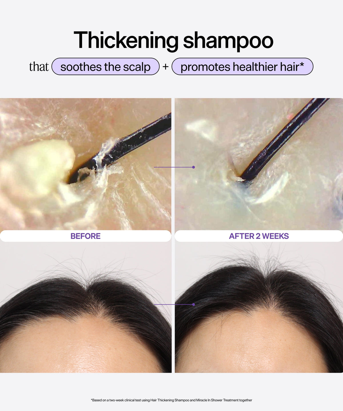Hair and Scalp Dynamic Duo Set